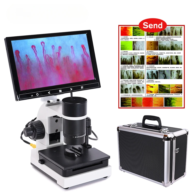 

profesional Nailfold Capillary Microcirculation USB HD digital Microscope Blood Microcirculation + 7" or 9" Color LCD Displayer