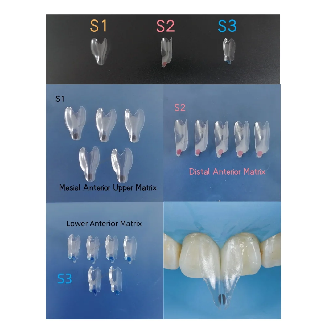 50Pcs Dental Widening Front Tranparent Clear Matrix BT Matrices Fits BioClear S1/2/3