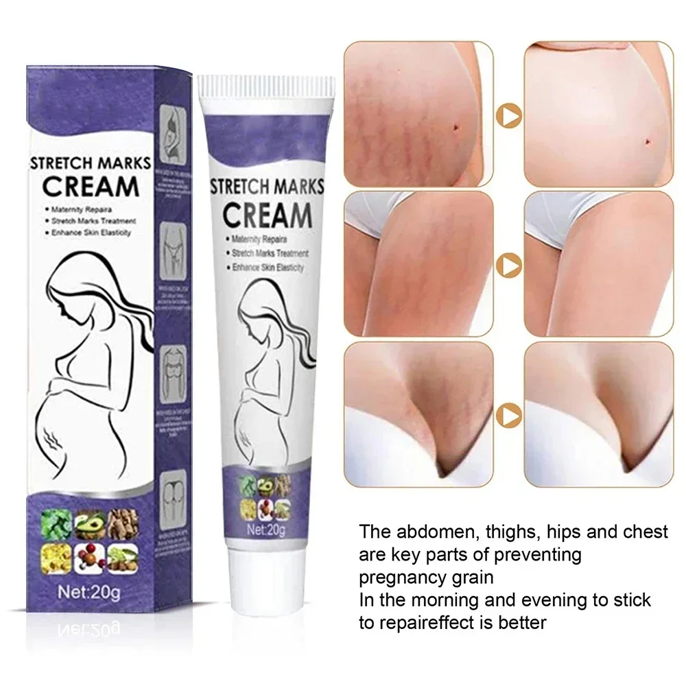 Stretch Mark Removal Cream Permanently Removes Stretch Marks Rejuvenates Skin