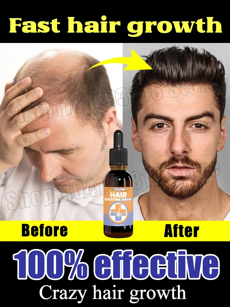 Hot sale in 2024, regain confidence, make hair more and more, say goodbye to baldness, thick hair