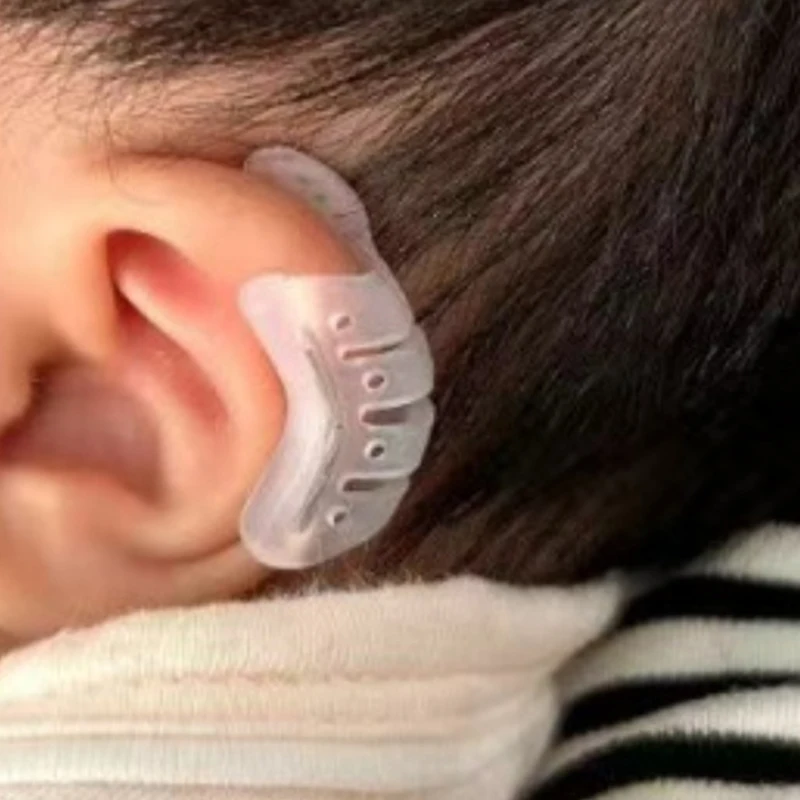 Protruding Ear Support Infant Corrector Tools Silicone Auricle Correction Patch For BabyEar Corrector Baby Auricle Valgus Corre