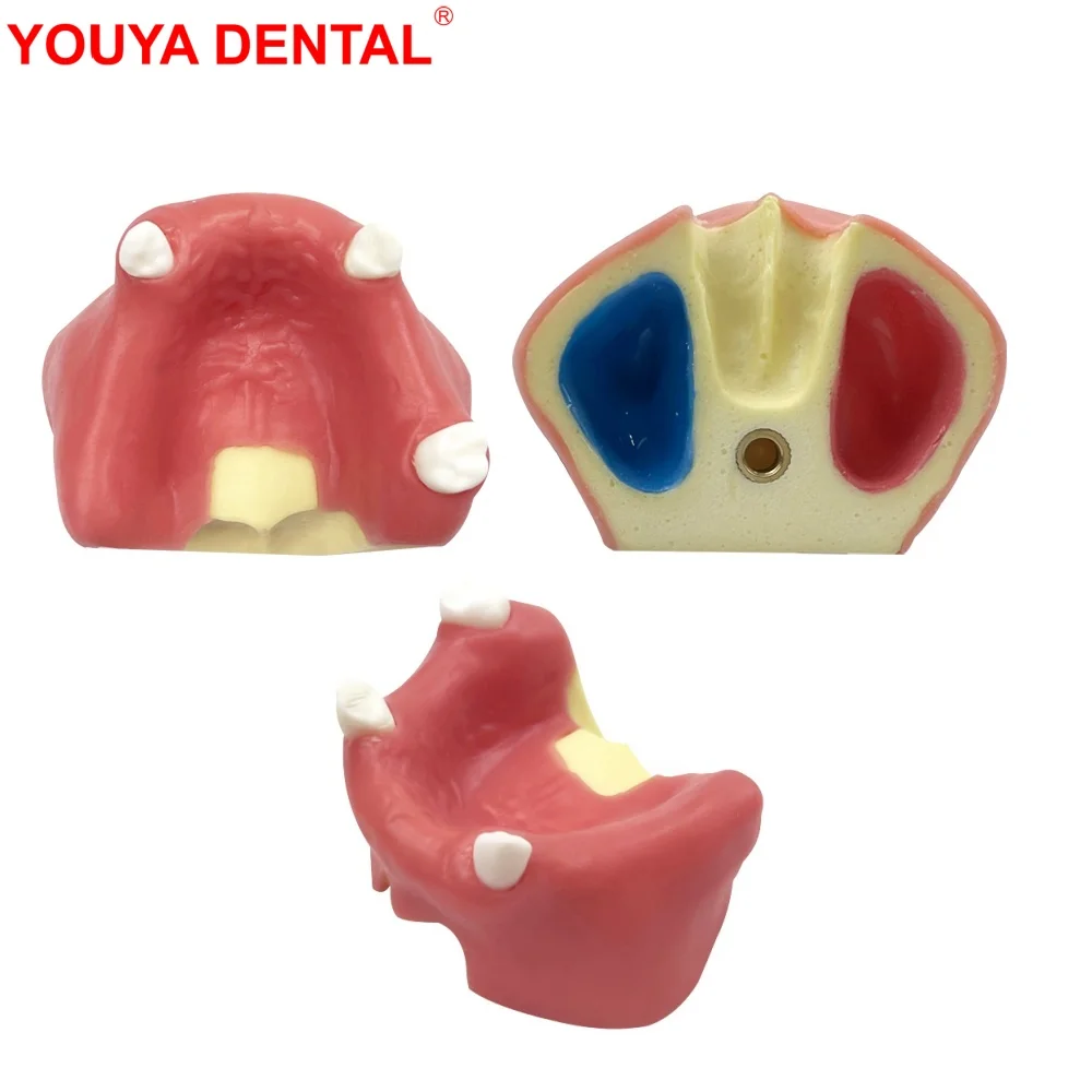 Dental Implant Teeth Teaching Model with 3 tooth For Dentist Students Training Exam Demonstration Dentistry Lab Practice Models