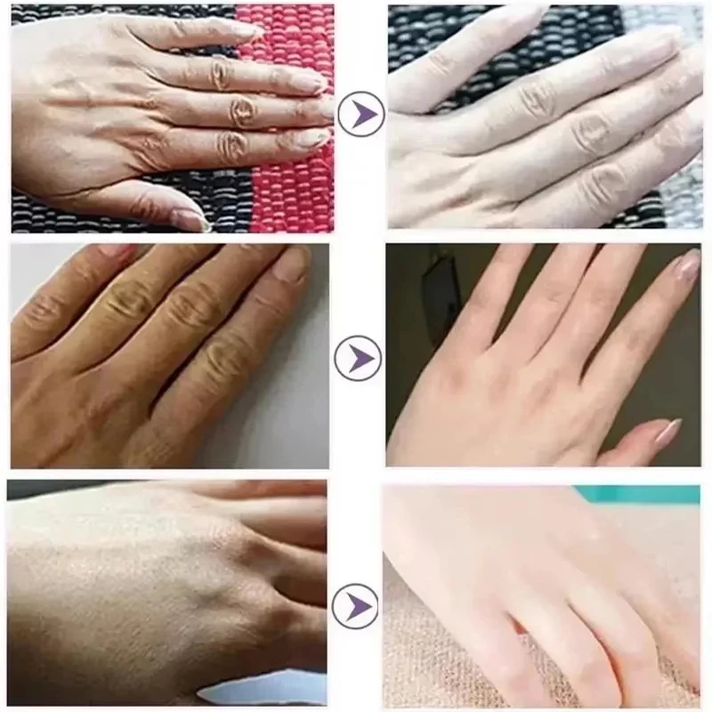 إزالة التجاعيد كريم اليد إصلاح اليد مكافحة التجفيف المضادة للتشقق الرعاية تليين تغذي تبييض ترطيب متصدع إصلاح المنتج