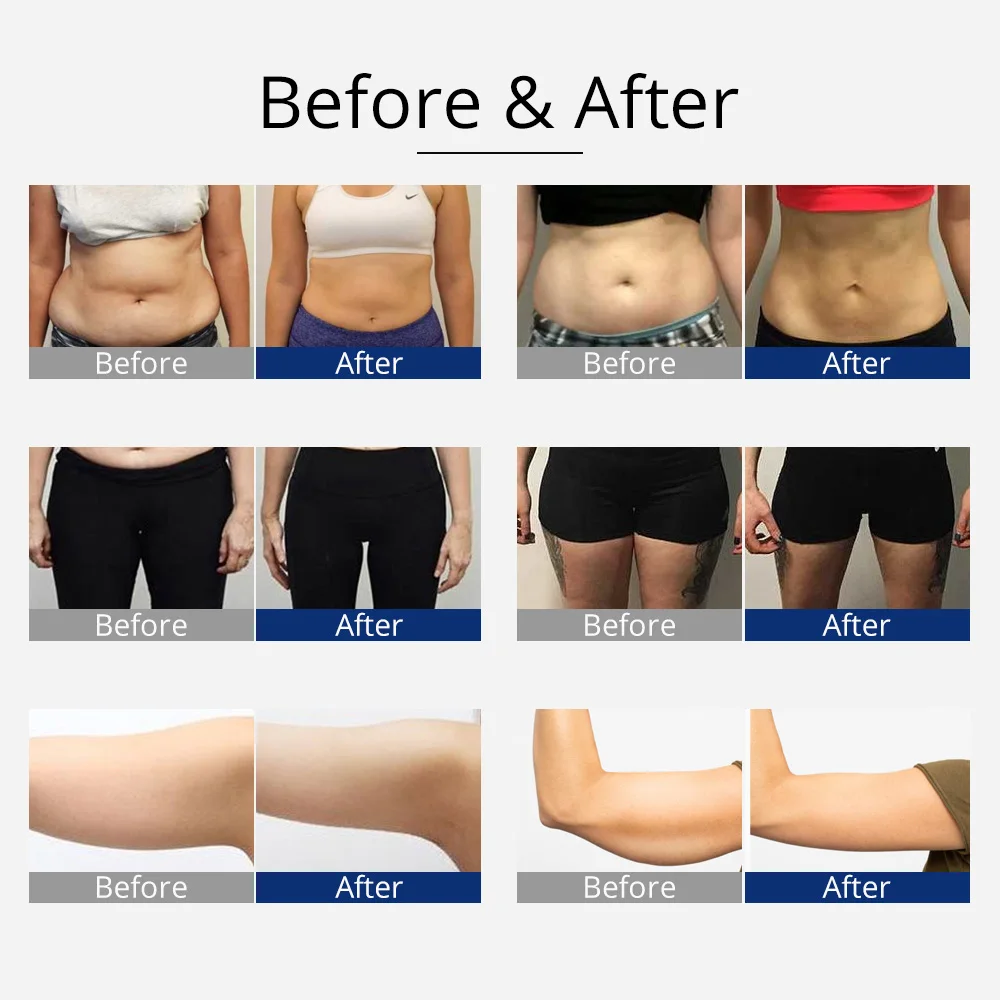 جديد 360 °   التلقائي الروتاري RF بالموجات فوق الصوتية التجويف فراغ آلة نحت الجسم