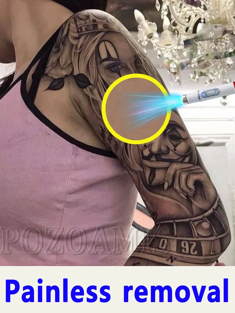 あらゆるサイズ、形、デザインのタトゥーを迅速に除去します。