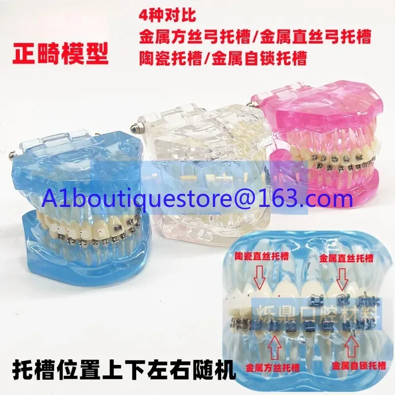 

Dental orthodontic model metal bracket ceramic bracket 4 kinds of comparative teaching explanation transparent dental mold
