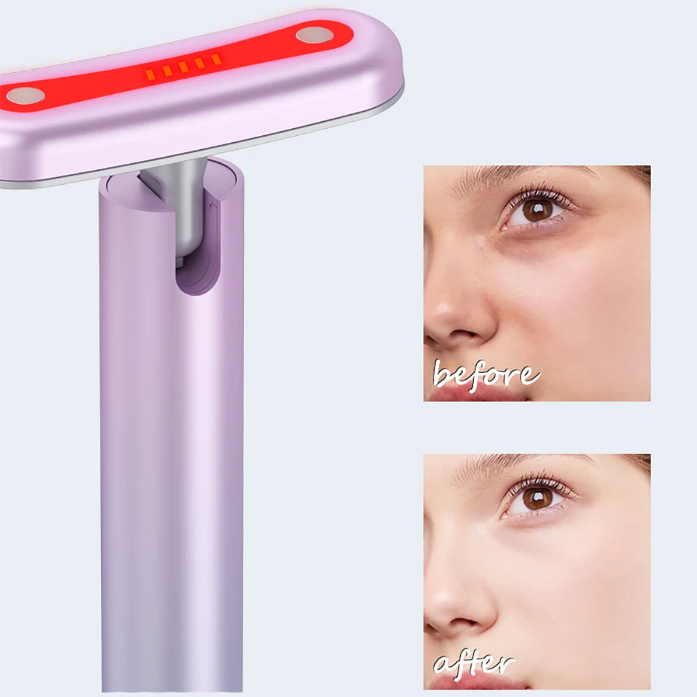 Red Light Therapy EMS Microcurrent Facial Wand Eye Dark Spots Hyperpigmentation Anti-aging Firming Tool