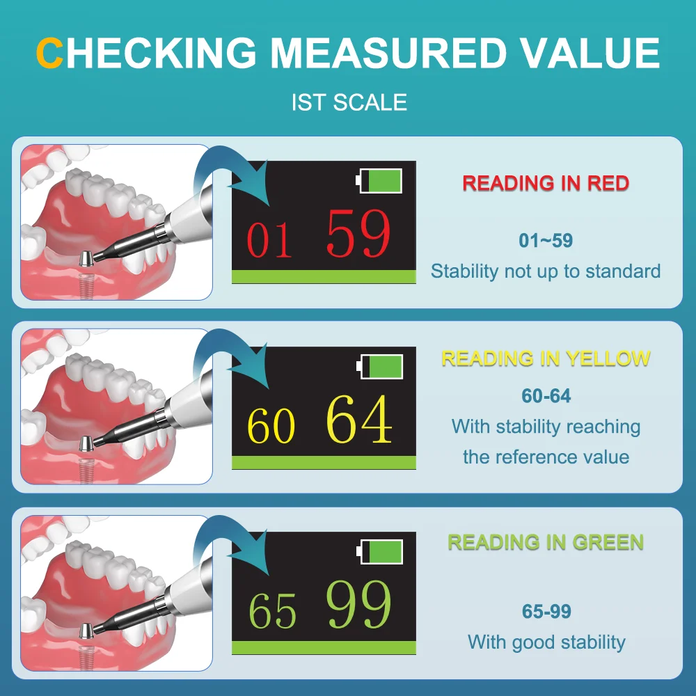 AI-CHECK Miernik stabilności implantów dentystycznych Monitor implantów Dokładne implanty pomiarowe Stabilność rezonansu Częstotliwość Narzędzie