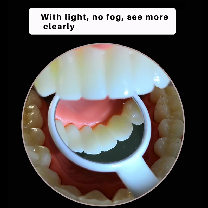 

Dentist mirror 1 Pc Led Light Teeth Oral Dental Mirror Super Bright Mouth Mirror
