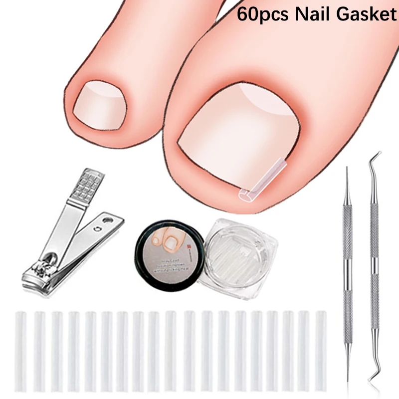 Ingrown Toenail Correction Tool Nail Filling Pad Ingrown Toe Nail Treatment Elastic Patch Straightening Clip Brace Pedicure Tool