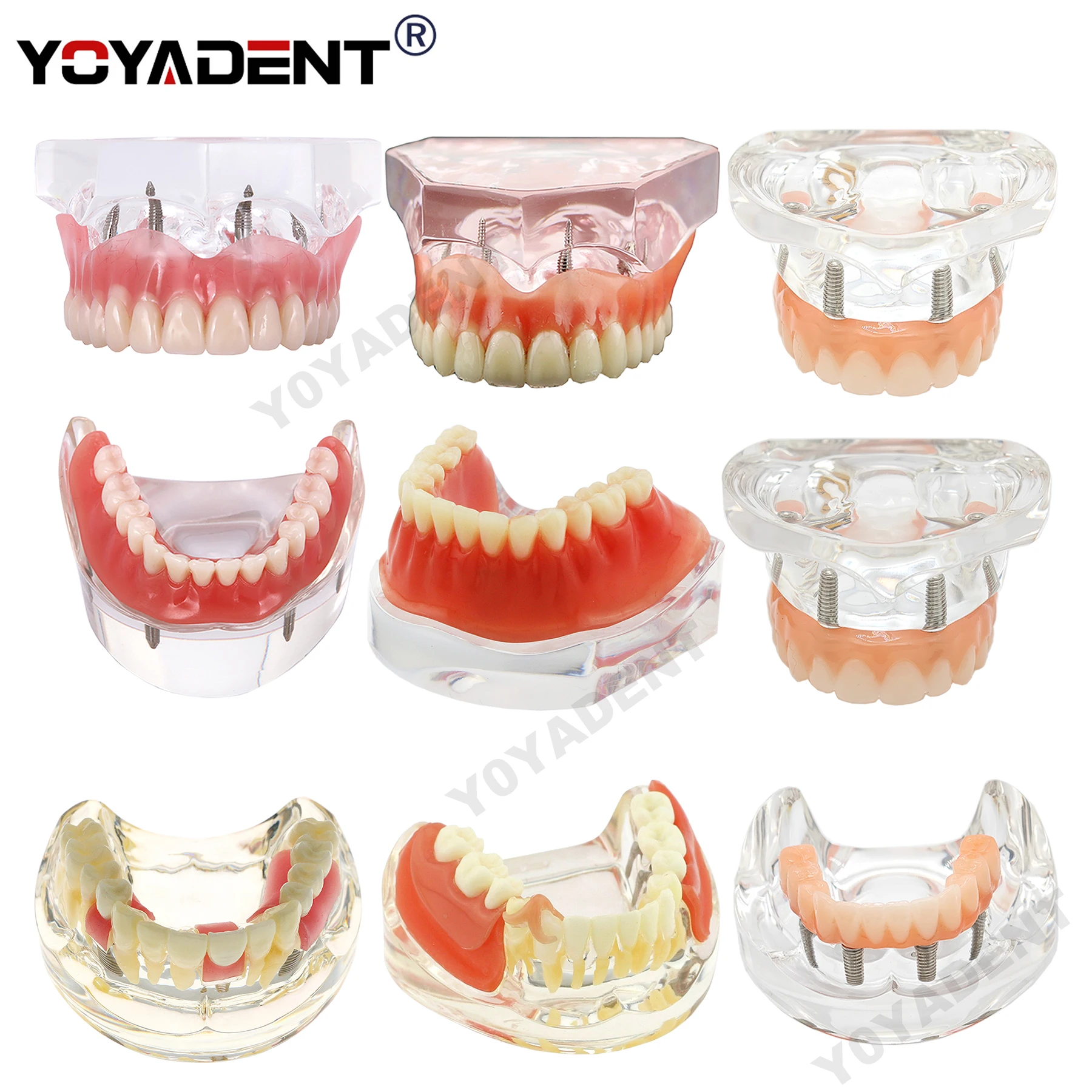 

Dental Model Teeth Model upper jaw/Lower Jaw Implant Restoration Model Dentist Patient Communication Treatment Study Demo