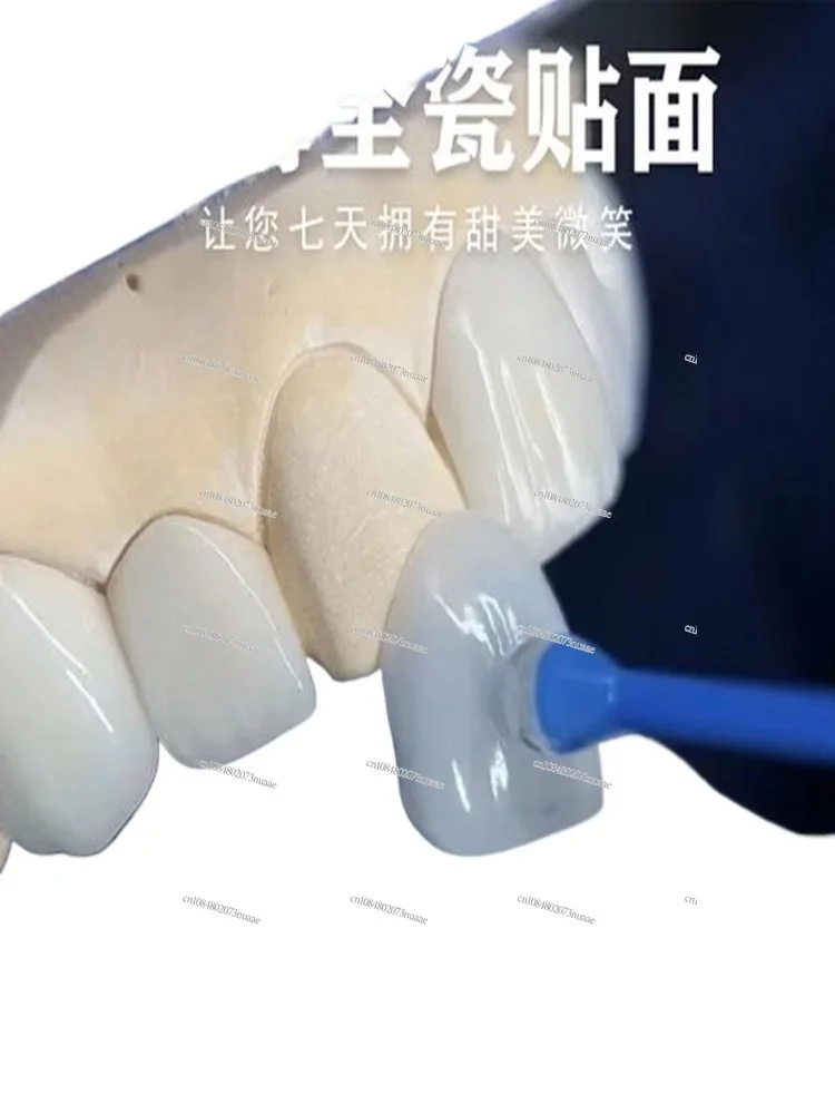 All-porcelain tooth stickers imported blue porcelain amber porcelain Lingxi porcelain ultra-thin tooth veneers