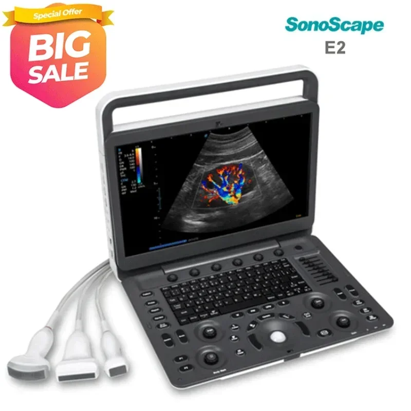 Medical Ultrasound Instruments ecografia portatil Sonoscape E2 Ultrasound Portable Color Doppler Ultrasound Machine