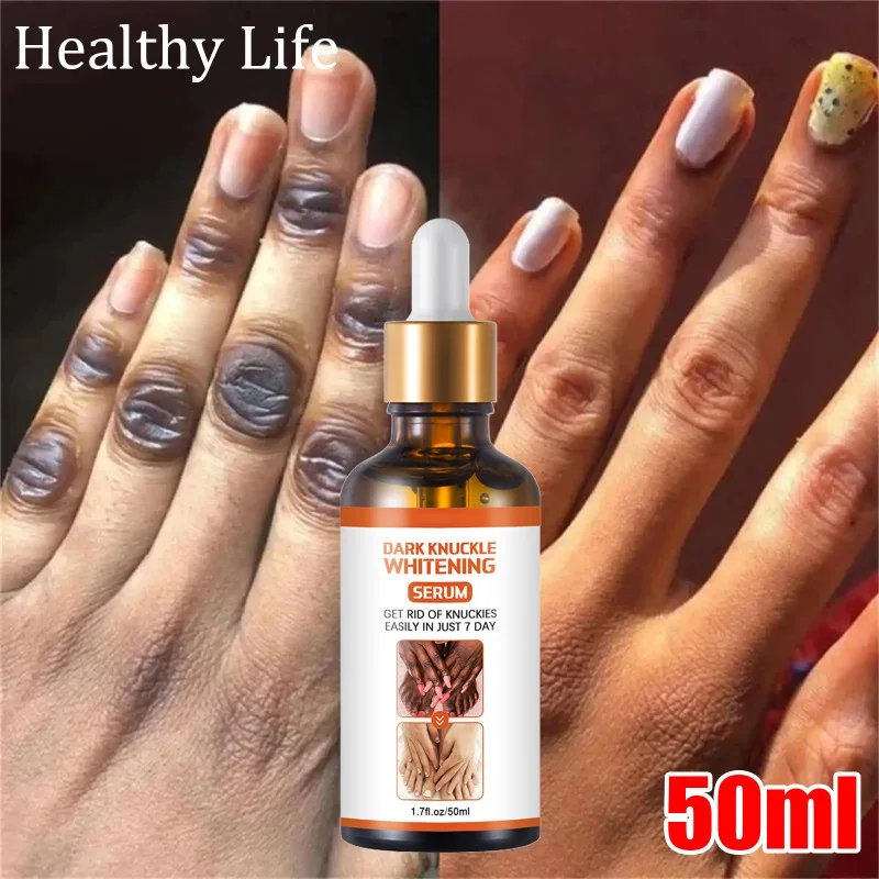 

Dark Knuckles Fast Brighten Women Hand Knuckle Lightening Essence Elbows Knee Fade Stains Product Brightening Care