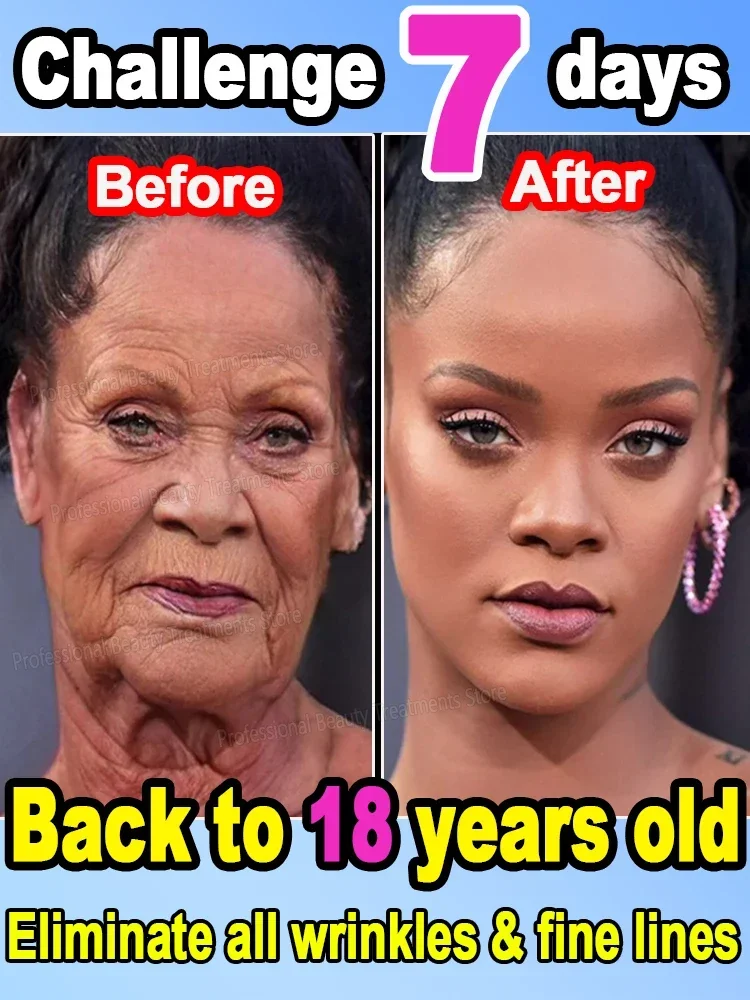 Wrinkles disappear Become beautiful now