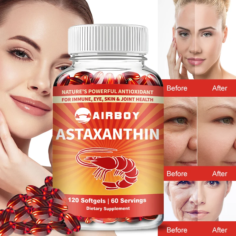 

Астаксантин - антиоксидант, поддерживает здоровье глаз, суставов, кожи и сердца, повышает метаболизм