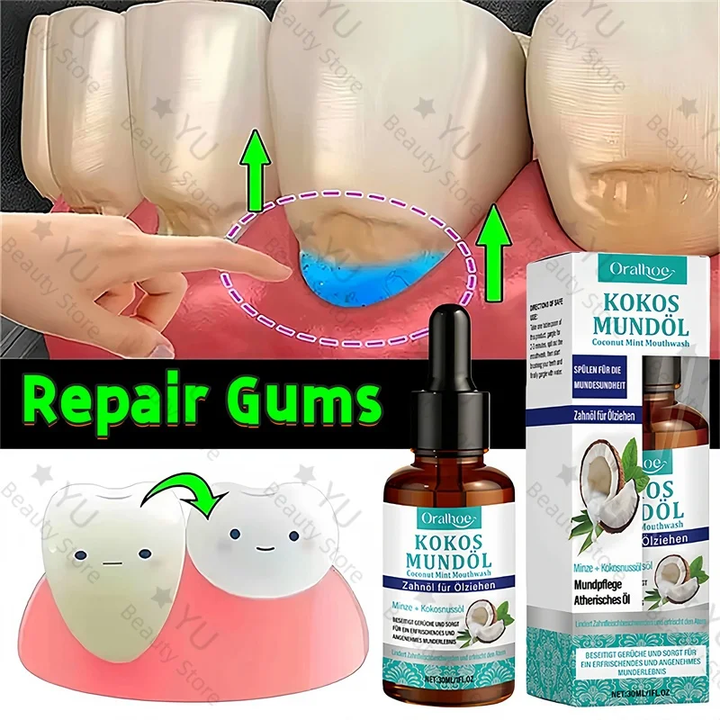 

Rapid Repair Gums Serum Effectively Relieve Tooth Allergy Dental Caries Tooth Cleaning Toothpaste Relieve Tooth Damage Drops