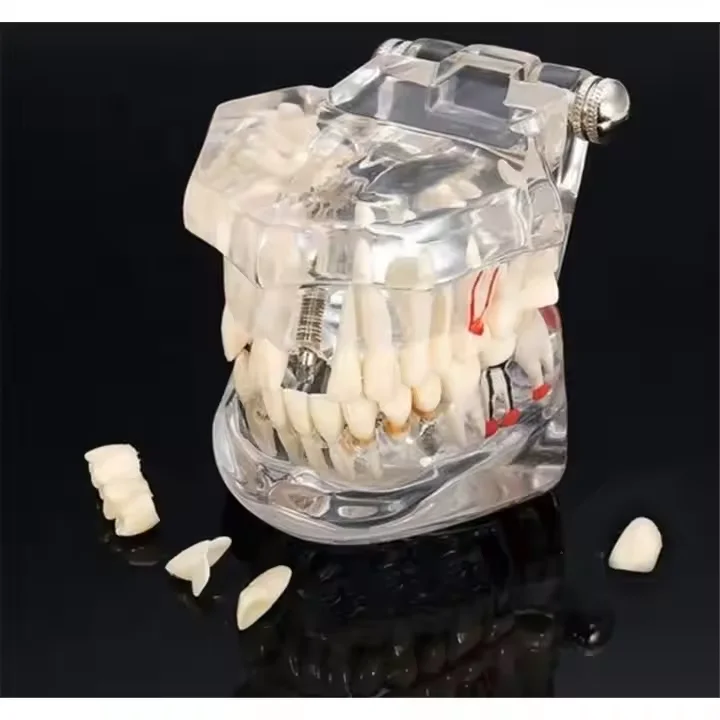 Denture Simulation Model for Oral Pathology Stomatology Teaching and Doctor-patient Communication Practice