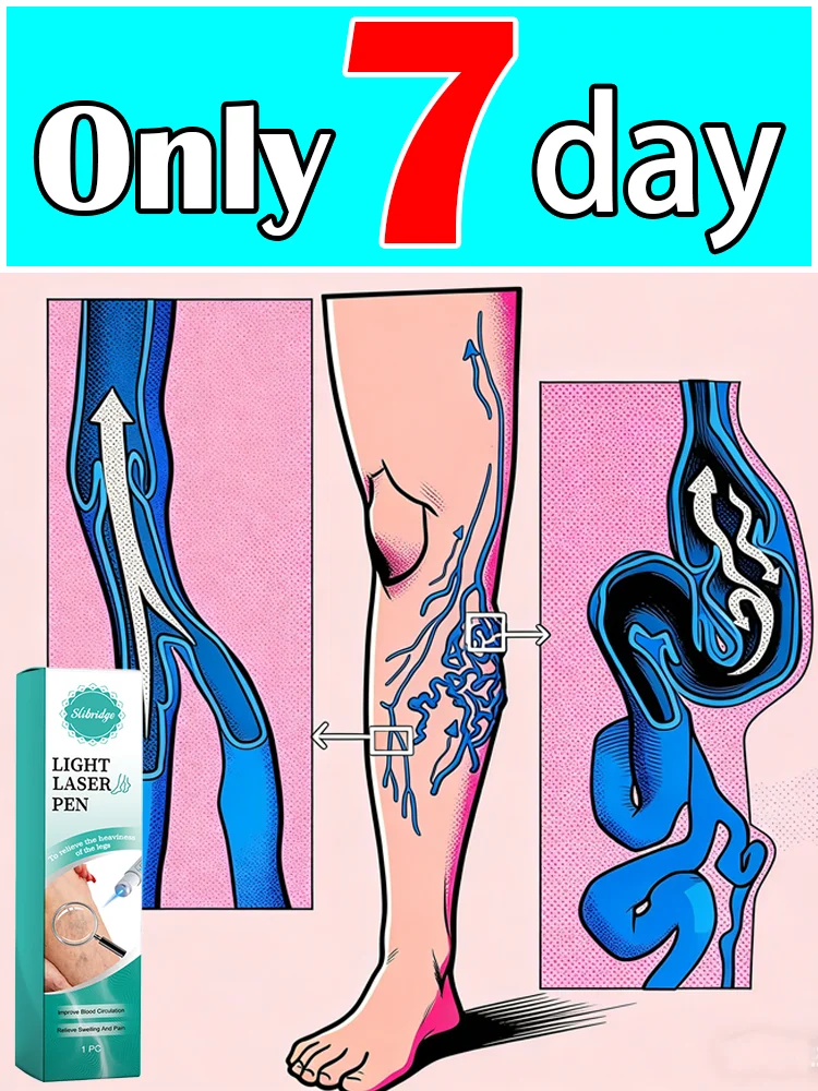 

Лазерная ручка с синим светом 2-го поколения, универсальный набор инструментов для ухода за ногами