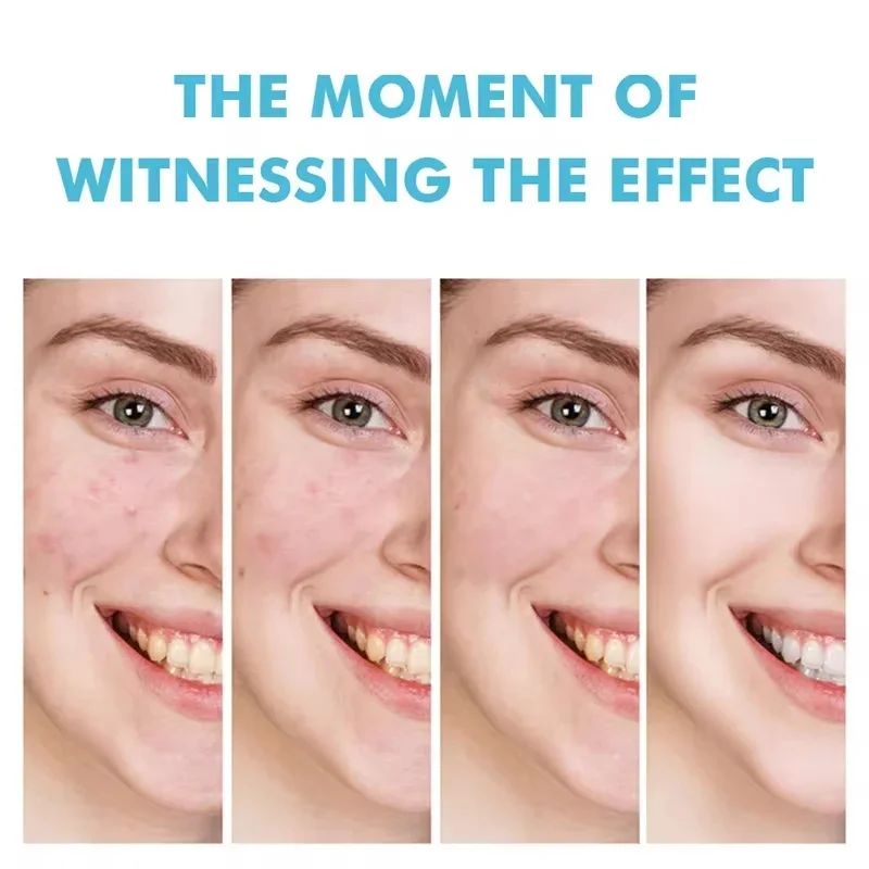 Acne Cream For Face Pimples Remover Treatment Shrink Pores Oil Control Lighten Acne Marks Whitening Smoothing Facial Skin Care view 4