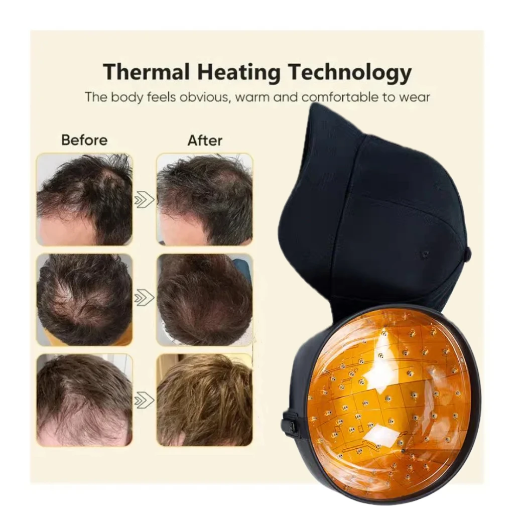 

HLKGO Hair Growth Cap, 96 Irradiation Laser, Oil Control, Rapid Hair Growth, Amazing Effect