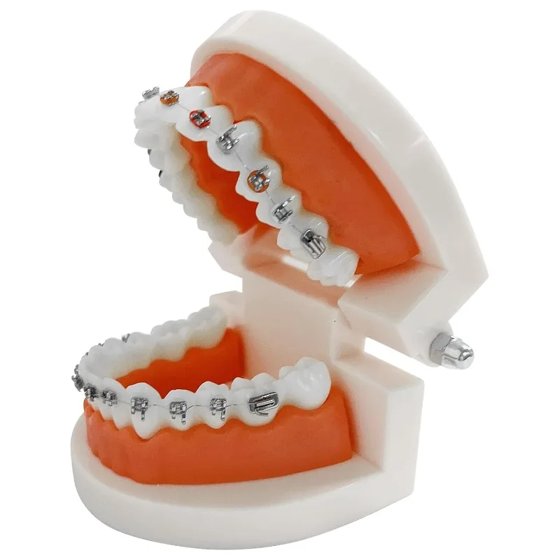Thumbnail 4 - #24 Best Selling Orthodontic Supplies