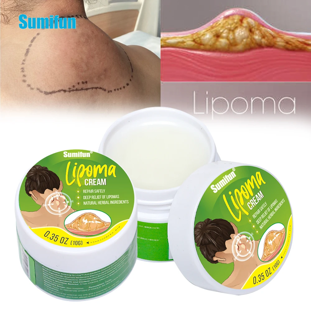 10 г, Sumifun Lipoma, средство для удаления грязи, подкожный крем для устранения отеков и жира