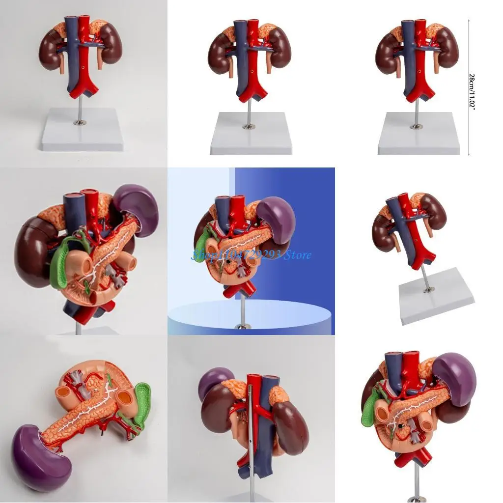 O modelo anatômico do Y2GD inclui aorta abdominal, pâncreas, baço e duodeno