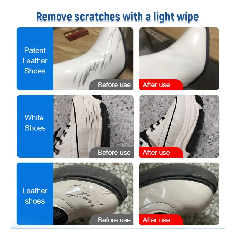 White Shoes Waterless Cleaner Specialized Stain Remover Sneaker Dry Cleaning Yellowing Cleaner