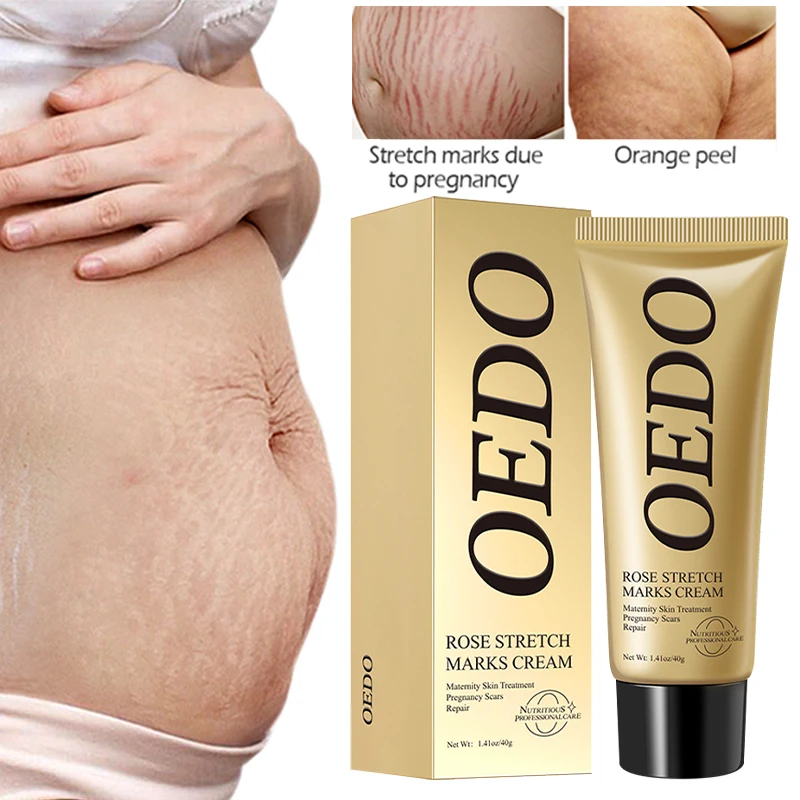 Abdomen Remove Stretch Marks Cream Anti Wrinkle Anti Aging Maternity Skin Repair Remove Pregnancy Scars Treatment Body Skin Care