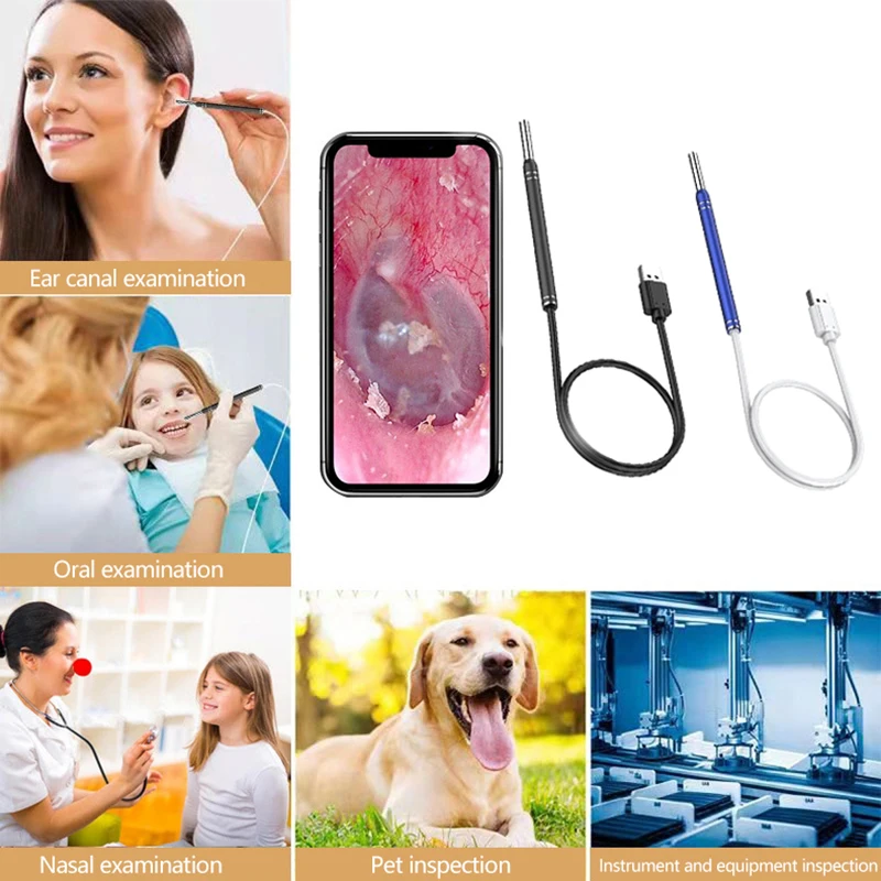 Smart Ear Cleaner Endoscope Spoon Camera Ear Picker Cleaning Wax Removal Visual Earpick Wifi Mouth Nose Otoscope Support Android