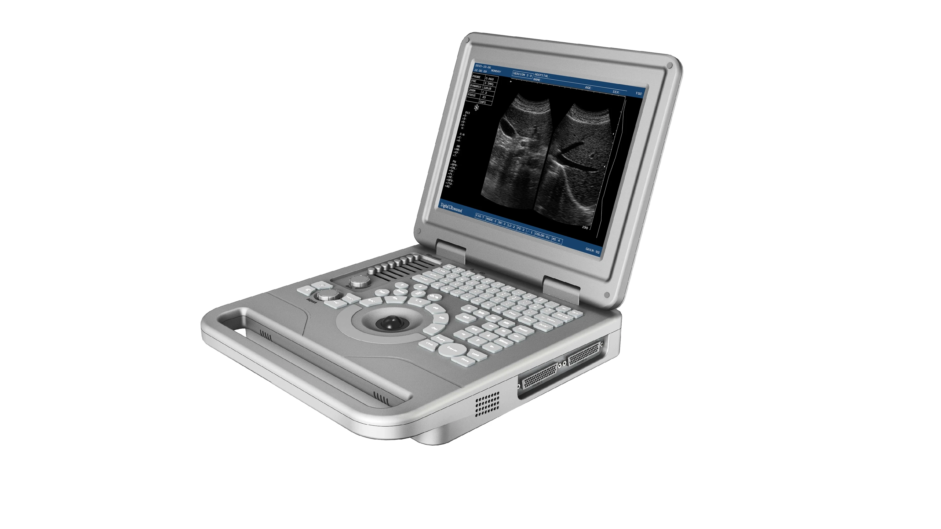 Hot Selling Mindray Ultrasound Machine for Human with High Quality