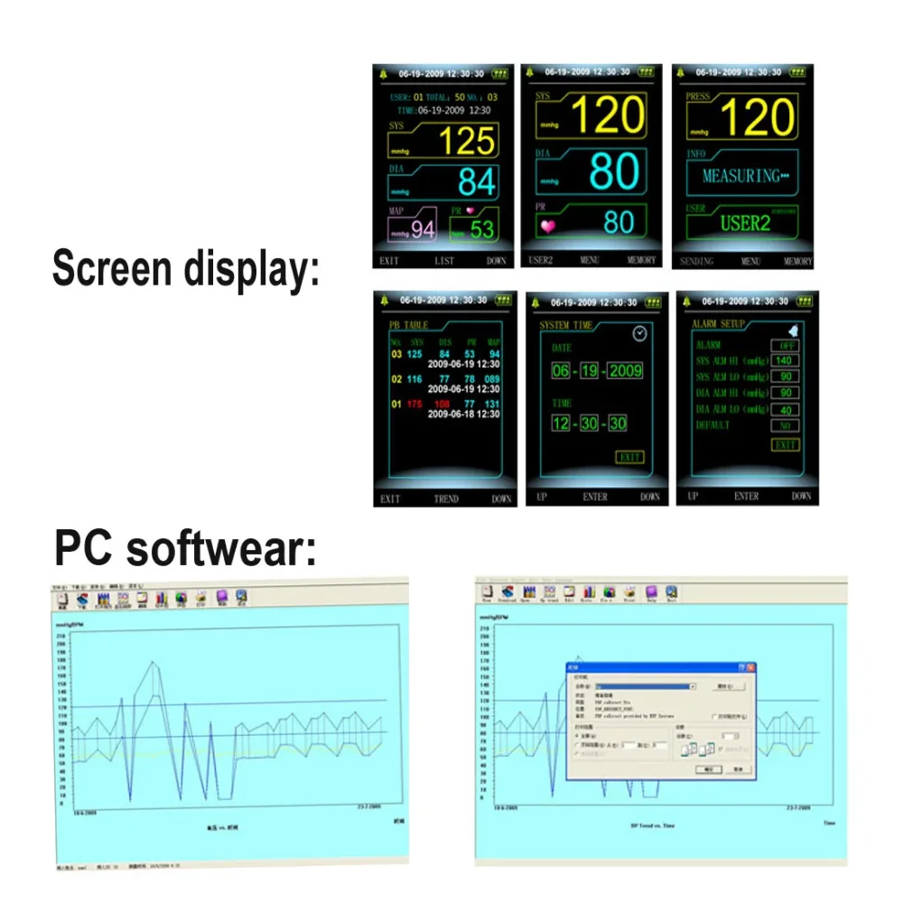 Contec New style Veterinary Equipment 08A-VET Digital Veterinary Blood Pressure Monitor NIBP Cuff, Monitor Veterinario, Dog/Cat