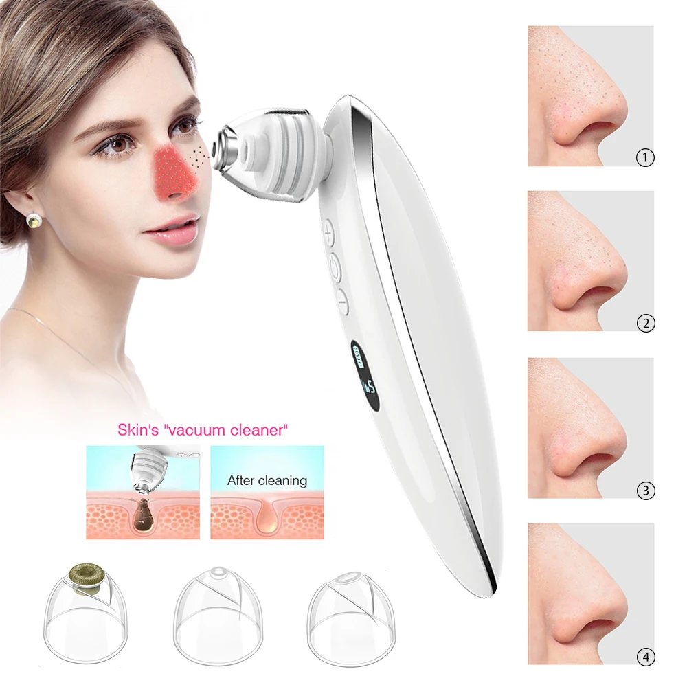 Elettrico per la rimozione dei punti neri Acne del viso Aspirapolvere Pore Adsorber Pulizia profonda dei pori Ricaricabile Strumento di bellezza per la cura della pelle