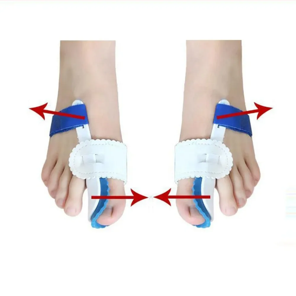 Corrector de Halux Valgus para dedos de los pies, separador de juanetes, separador de juanetes, 2 piezas