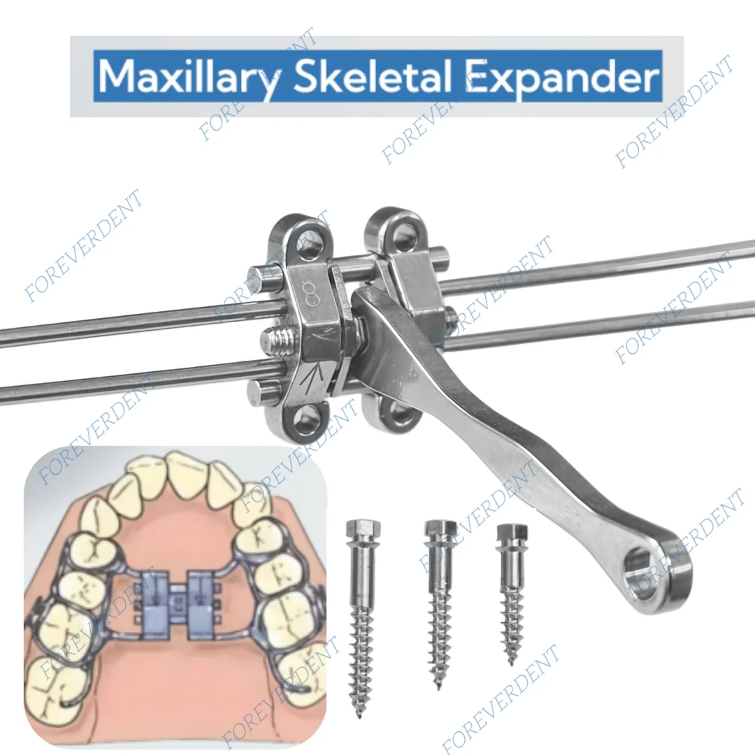 

Стоматологический расширительный винт MSE, верхнещелючевой ракелетный расширитель, ортопедический параллельный инструмент для среднего лица, 8 мм/10 мм/12 мм, 3 размера