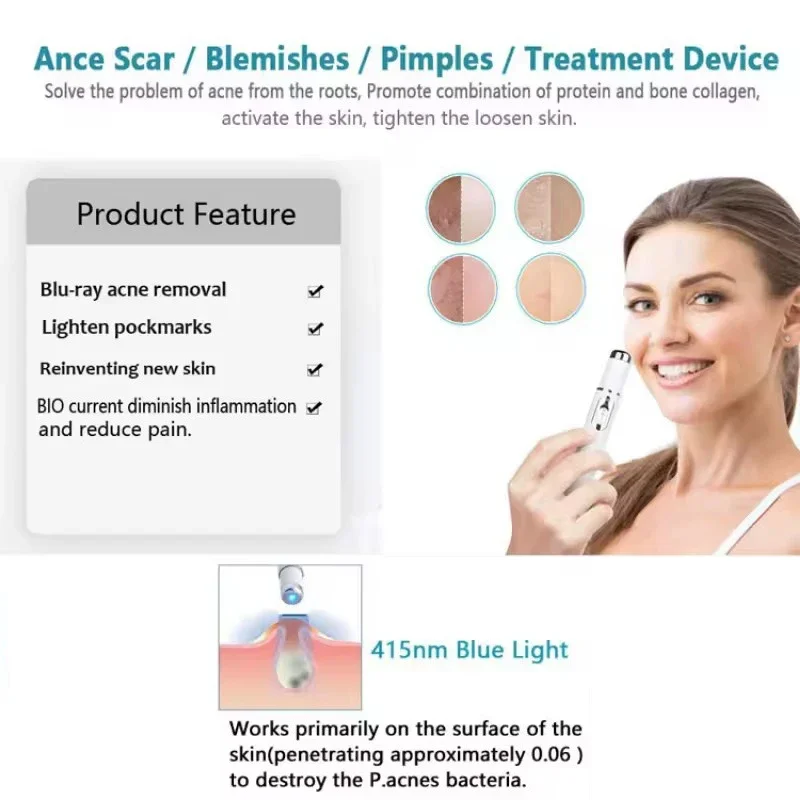 جهاز تجميل الوجه، أزرق فاتح للعين، دوائر العين السوداء، أداة العناية بالوجه، تفتيح الملمس، الحفاظ على أكياس العين #5