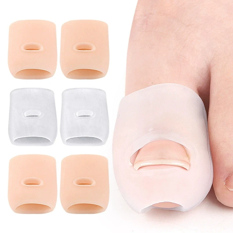 1/2Pairs Silicone Toe Protector Separator Ingrown Toenail Correction Cover Toe Ingrown Nail Corrector Toe Curled Nail Stretching