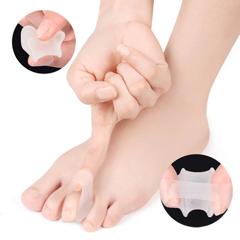 Separador Toe Silicone macio, pé sobreposição corrector, anti-desgaste cuidados almofadas, ferramentas de pedicure, tratar Hallux, Valgus, joanete, 1 par