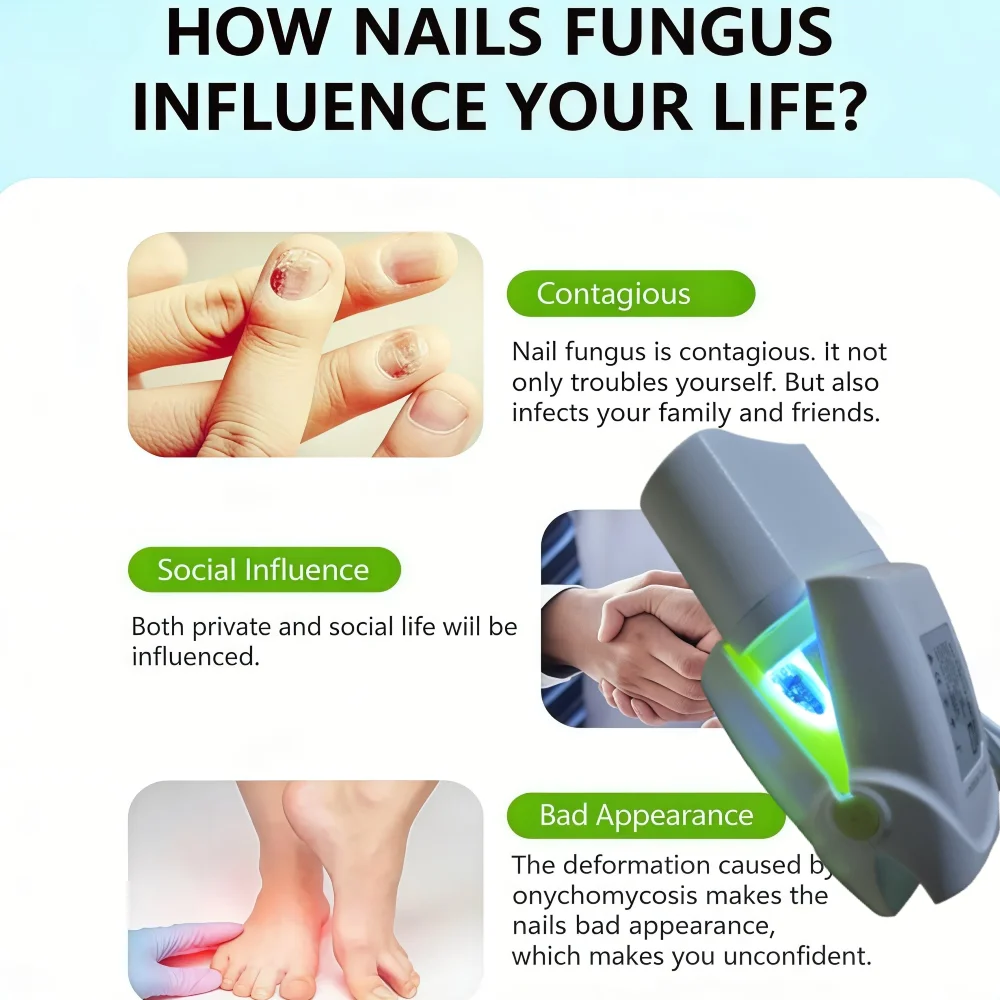 

Toenail and Fingernail Fungus Laser Care Device Upgrade for Onychomycosis Fast Painless Support