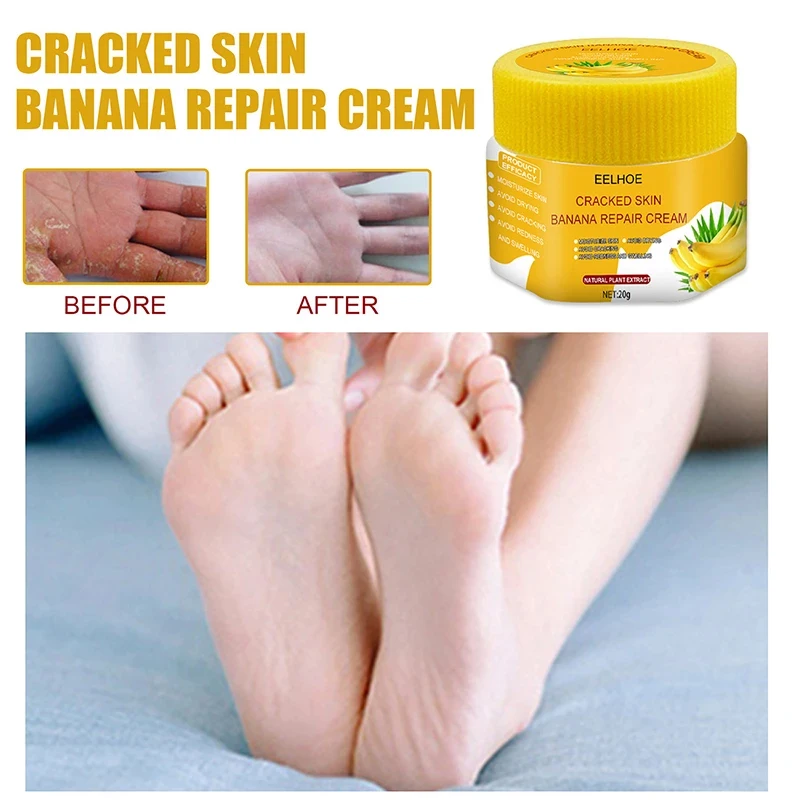 

Foot Cream Anti-Aging Anti-Wrinkle Anti-Drying Rough Exfoliating Dead Skin Moisturizing Whitening Nourishes The Skin Foot Care