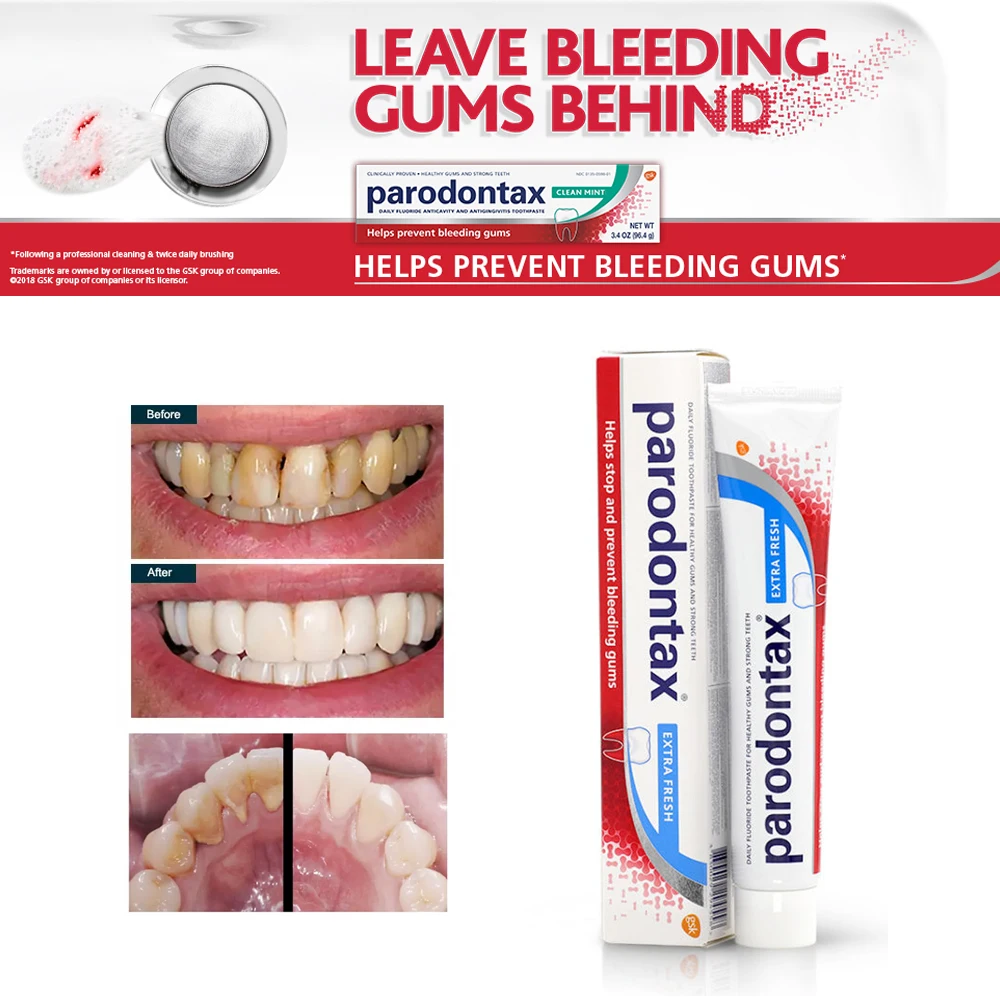 Parodontax Toothpaste Dental Periodontal Gum Disease Treatment Haleon Gingivitis Repair Drops Strong Teeth Oral Care Products