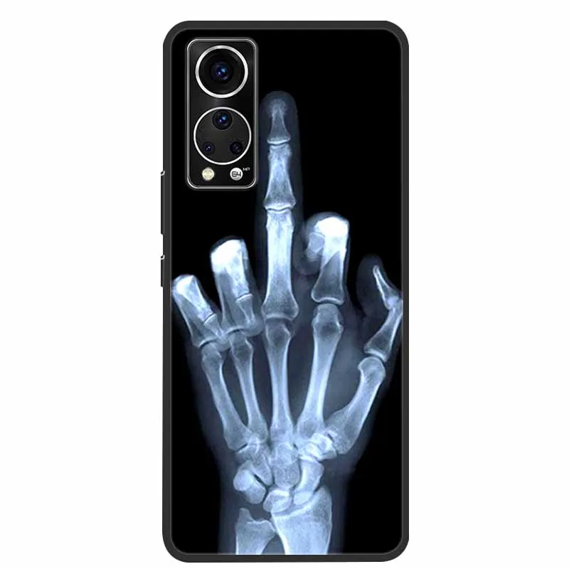 For ZTE Axon 30 Phone Case Cover Cool Wolf Lion Tiger Black Silicone Soft Funda For ZTE Axon 30 Back Cover Case Axon30 5G Coque