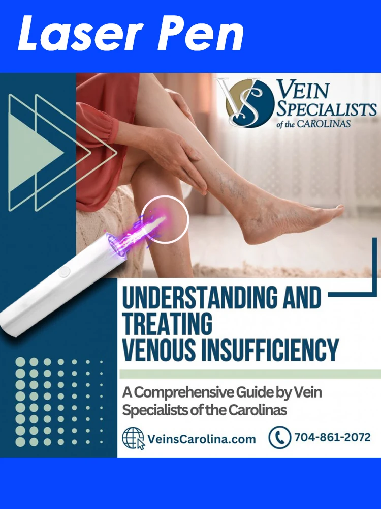 

Лазерная терапия вен, ручка для ног, светотерапия для варикозного расширения вен, устройство синего света, уход за кожей