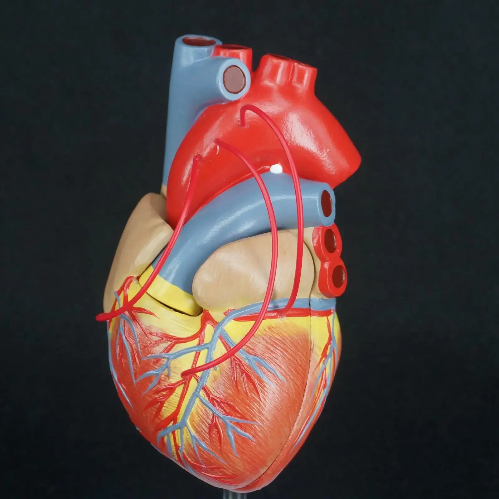 Scientific Heart with Bypass Life Size Anatomical Model Anatomy Teaching Resources