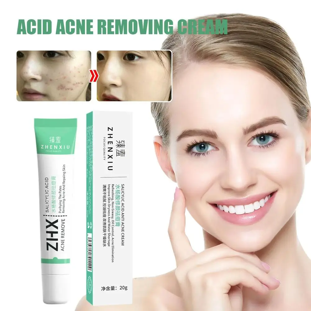 Crema para eliminar el acné y el acné, tratamiento de belleza de 20g con ácido salicílico, aclara suavemente el acné, regula la piel, elimina las marcas de acné, Remo H0x9