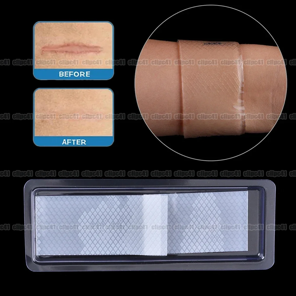 10Pcs 3.5*12cm Removal Silicone Gel Away Silicone Scar Sheets Silicon Gel Patch Scars Caused By Injuries Burns Efficient Beauty