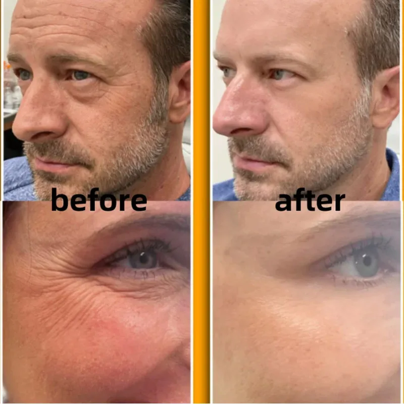 Whitening Sproeten Gezichtscrème Vitamine C Verwijderen Melasma Donkere Vlekken Crème Fade Melanine Hydrateren Helderder Gladde Schoonheid Huidverzorging