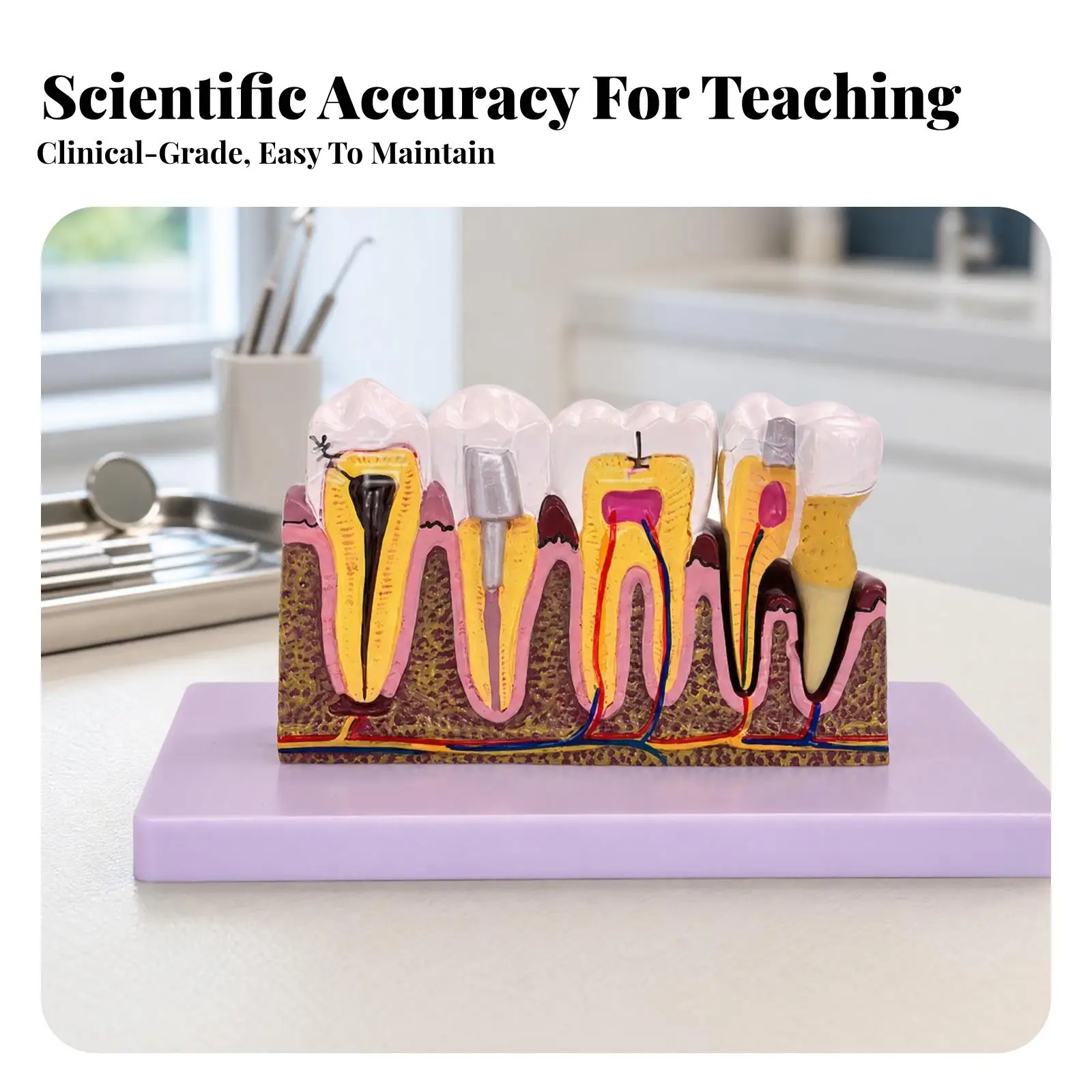 Dental Pathology Display Model Enlarged Cross Section Tooth Anatomy with Caries Root Canal Pulp for Education