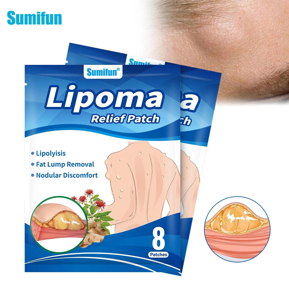 8/40/80Pcs Sumifun Lipoma Removal Patch Anti Skin Tumor Swelling Fat Lump Nodular Reduce Inflammation Subcutaneous Mass Plaster